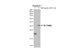 Anti-IL1 beta antibody [HL3084] used in Western Blot (WB). GTX640530