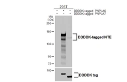 Anti-NTE antibody [HL3127] used in Western Blot (WB). GTX640613