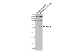 Anti-Kv1.1 antibody [HL3162] used in Western Blot (WB). GTX640672