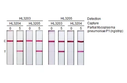 Anti-Mycoplasma pneumoniae P1 protein antibody [HL3203] used in Lateral Flow (Lateral Flow). GTX640843