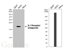 Anti-IL1 Receptor antagonist antibody [HL3228] used in Western Blot (WB). GTX640869