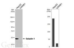 Anti-Seladin 1 antibody [HL3253] used in Western Blot (WB). GTX640900