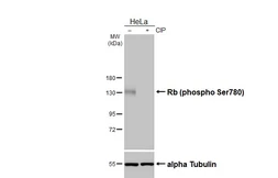 Anti-Rb (phospho Ser780) antibody [HL3285] used in Western Blot (WB). GTX640939