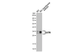 Anti-GITR antibody [HL3289] used in Western Blot (WB). GTX640943