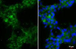 Anti-alpha 1a Adrenergic Receptor antibody [HL3291] used in Immunocytochemistry/ Immunofluorescence (ICC/IF). GTX640945