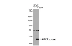Anti-Respiratory Syncytial virus Fusion protein antibody [GT20] used in Western Blot (WB). GTX640951