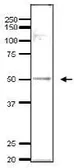 Anti-Ada2 (S. cerevisiae) antibody used in Western Blot (WB). GTX64096