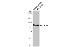 Anti-CASK antibody [GT27] used in Western Blot (WB). GTX641106