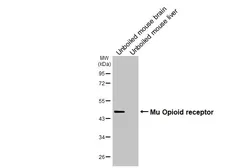 Anti-Mu Opioid receptor antibody [HL3348] used in Western Blot (WB). GTX641120