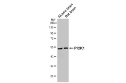 Anti-PICK1 antibody [GT32] used in Western Blot (WB). GTX641124