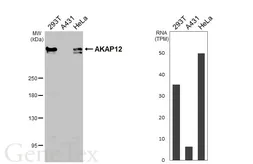 Anti-AKAP12 antibody [HL3364] used in Western Blot (WB). GTX641184