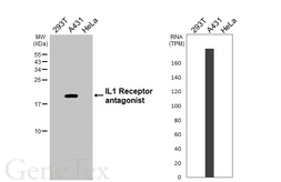 Anti-IL1 Receptor antagonist antibody [HL3366] used in Western Blot (WB). GTX641186