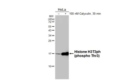Anti-Histone H3T3ph (phospho Thr3) antibody [HL3381] used in Western Blot (WB). GTX641201