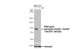 Anti-RSK (pan) (phospho Ser221 / Ser227 / Ser218 / Ser232) antibody [HL3427] used in Western Blot (WB). GTX641269
