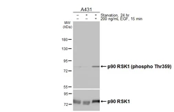Anti-p90 RSK1 (phospho Thr359) antibody [HL3429] used in Western Blot (WB). GTX641271