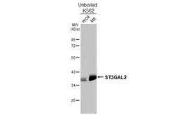 Anti-ST3GAL2 antibody [HL3457] used in Western Blot (WB). GTX641342