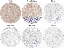 Anti-Adenosine A1 Receptor antibody [H341] HistoMAX&trade; used in IHC (Paraffin sections) (IHC-P). GTX641402