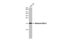 Anti-Histone H2A.X antibody [HL3515] used in Western Blot (WB). GTX641412