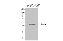 Anti-GCLM antibody [HL3517] used in Western Blot (WB). GTX641414