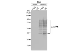 Anti-CXCR5 antibody [HL3568] used in Western Blot (WB). GTX641474