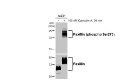 Anti-Paxillin (phospho Ser273) antibody [HL3588] used in Western Blot (WB). GTX641559
