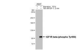 Anti-IGF1R beta (phospho Tyr950) antibody [HL3607] used in Western Blot (WB). GTX641582