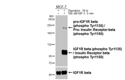 Anti-IGF1R beta (phospho Tyr1135) / Insulin Receptor beta (phospho Tyr1150) antibody [HL3614] used in Western Blot (WB). GTX641589