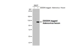 Anti-Adenovirus hexon antibody [HL3684] used in Western Blot (WB). GTX641712