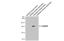 Anti-CASPR antibody [GT82] used in Western Blot (WB). GTX641887