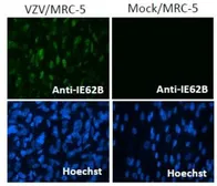Anti-Varicella Zoster virus IE62 antibody [62B] used in Immunocytochemistry/ Immunofluorescence (ICC/IF). GTX64190