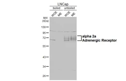 Anti-alpha 2a Adrenergic Receptor antibody [HL3723] used in Western Blot (WB). GTX641913