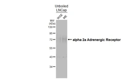 Anti-alpha 2a Adrenergic Receptor antibody [HL3725] used in Western Blot (WB). GTX641915