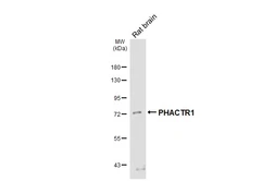 Anti-PHACTR1 antibody [HL3726] used in Western Blot (WB). GTX641916