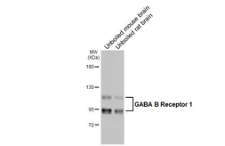 Anti-GABA B Receptor 1 antibody [GT83] used in Western Blot (WB). GTX641938
