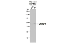 Anti-LRRC15 antibody [HL3750] used in Western Blot (WB). GTX641949