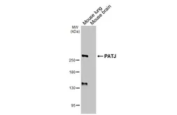 Anti-PATJ antibody [HL3842] used in Western Blot (WB). GTX642076
