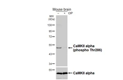 Anti-CaMKII (phospho Thr286) antibody [HL3848] used in Western Blot (WB). GTX642082