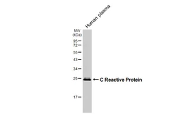 Anti-C Reactive Protein antibody [HL3867] used in Western Blot (WB). GTX642105