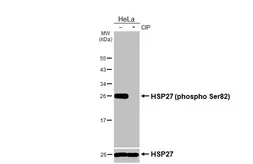 Anti-HSP27 (phospho Ser82) antibody [HL3889] used in Western Blot (WB). GTX642130