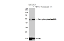 Anti-Tau (phospho Ser235) antibody [HL3899] used in Western Blot (WB). GTX642140
