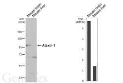 Anti-Ataxin 1 antibody [GT106] used in Western Blot (WB). GTX642154
