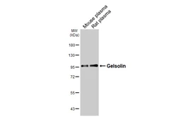 Anti-Gelsolin antibody [HL3943] used in Western Blot (WB). GTX642193