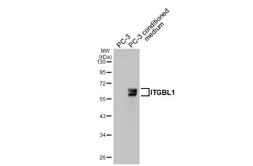 Anti-ITGBL1 antibody [HL3944] used in Western Blot (WB). GTX642194