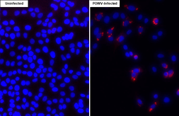 Anti-Powassan virus NS3 antibody [HL3968] used in Immunocytochemistry/ Immunofluorescence (ICC/IF). GTX642218
