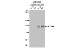 Anti-ATP7A antibody [GT128] used in Western Blot (WB). GTX642327