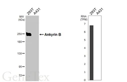Anti-Ankyrin B antibody [GT131] used in Western Blot (WB). GTX642448