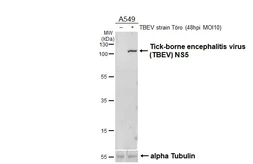 Anti-Tick-borne encephalitis virus (TBEV) NS5 antibody [HL4062] used in Western Blot (WB). GTX642477