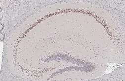 Anti-MATH2 antibody [HL4081] used in IHC (Paraffin sections) (IHC-P). GTX642520