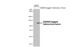 Anti-Adenovirus hexon antibody [HL4129] used in Western Blot (WB). GTX642575