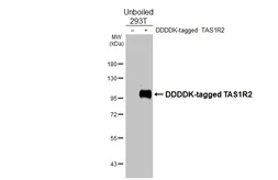 Anti-TAS1R2 antibody [HL4180] used in Western Blot (WB). GTX642994